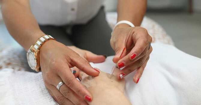 Discover the Holistic Benefits of Acupuncture: Beyond Just Pain Relief image